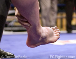 Ring of Combat 14: Erik Charles' foot swells due to his fight-ending injury incurred in his fight vs. Lyman Good - Photo by Tom DeFazio